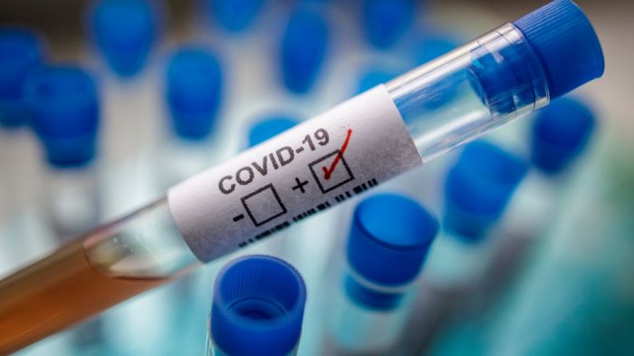 Какая группа крови наименее подвержена заражению КОВИД-19?